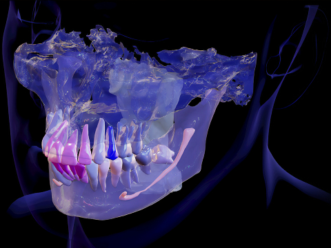 ИИ-диагностика Diagnocat